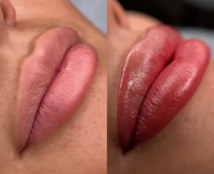 Cosmetic Tattoo